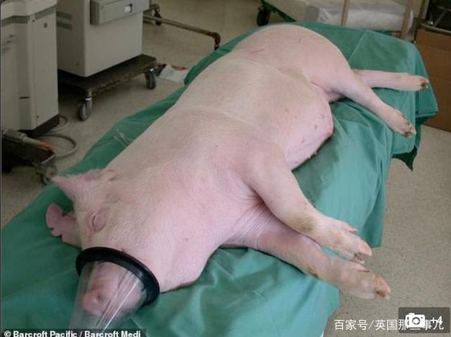 世界首次 猪心脏移植到人类体内已正常跳动三天